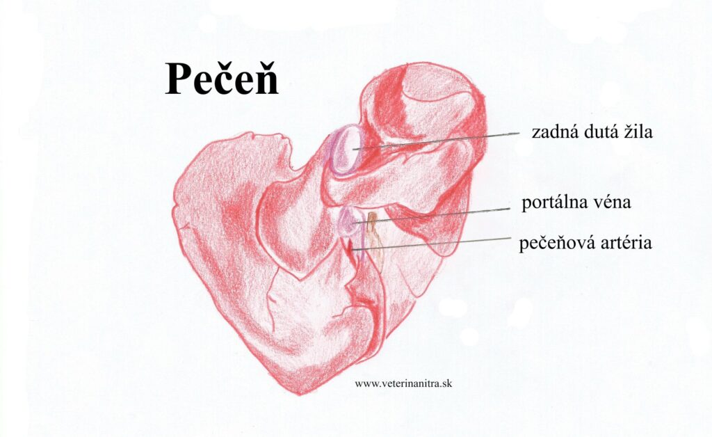 Pečeňová mikrovaskulárna dysplázia (HMD)